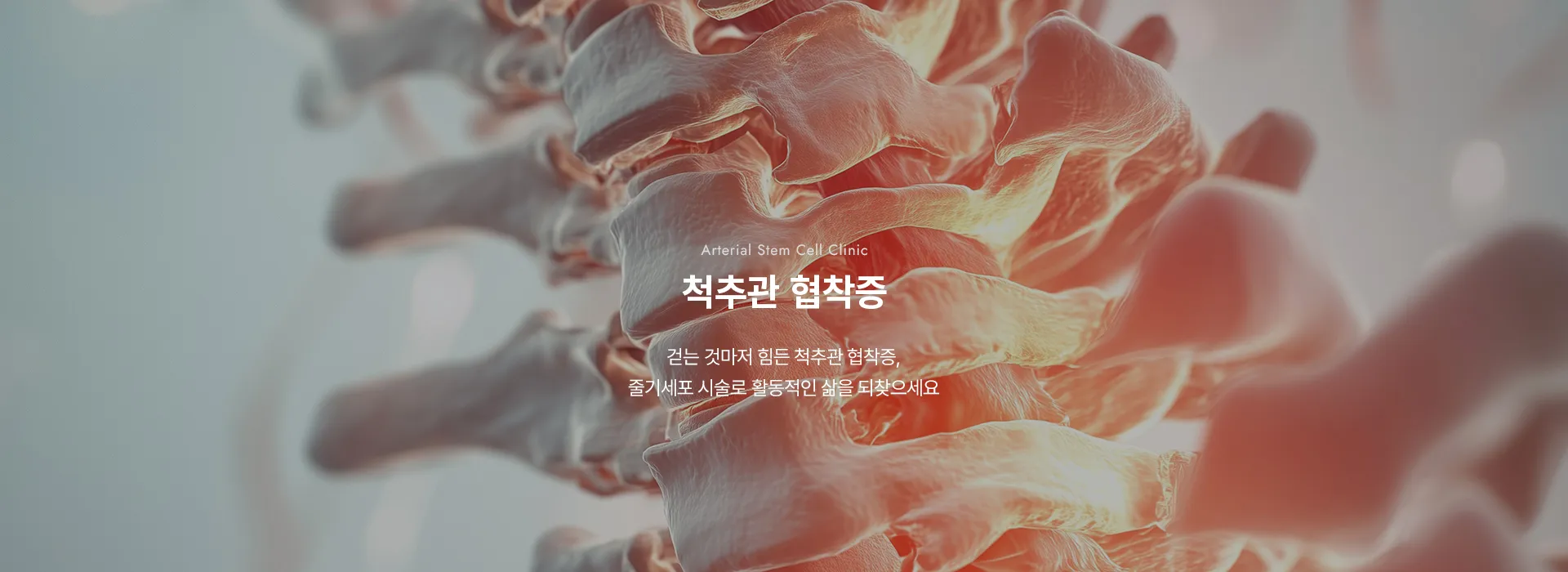 Arterial Stem Cell Clinic · 척추관 협착증 · 걷는 것마저 힘든 척추관 협착증, 줄기세포 시술로 활동적인 삶을 되찾으세요