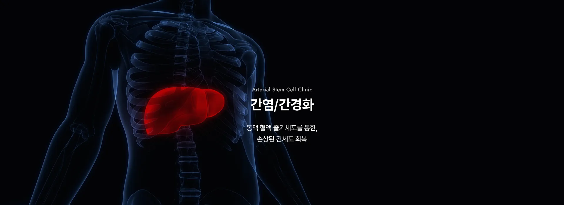 Arterial Stem Cell Clinic · 간염/간경화 · 동맥 혈액 줄기세포를 통한, 손상된 간세포 회복