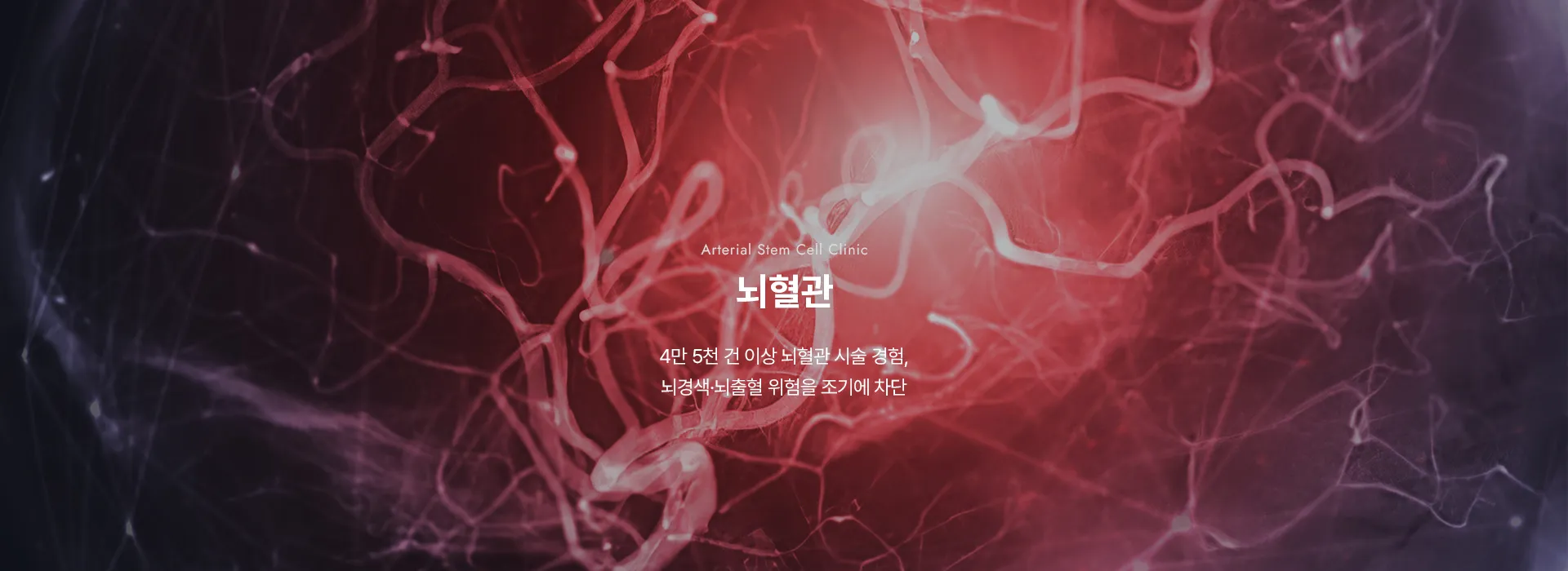 Arterial Stem Cell Clinic · 뇌혈관 · 4만 5천 건 이상 뇌혈관 시술 경험, 뇌경색·뇌출혈 위험을 조기에 차단