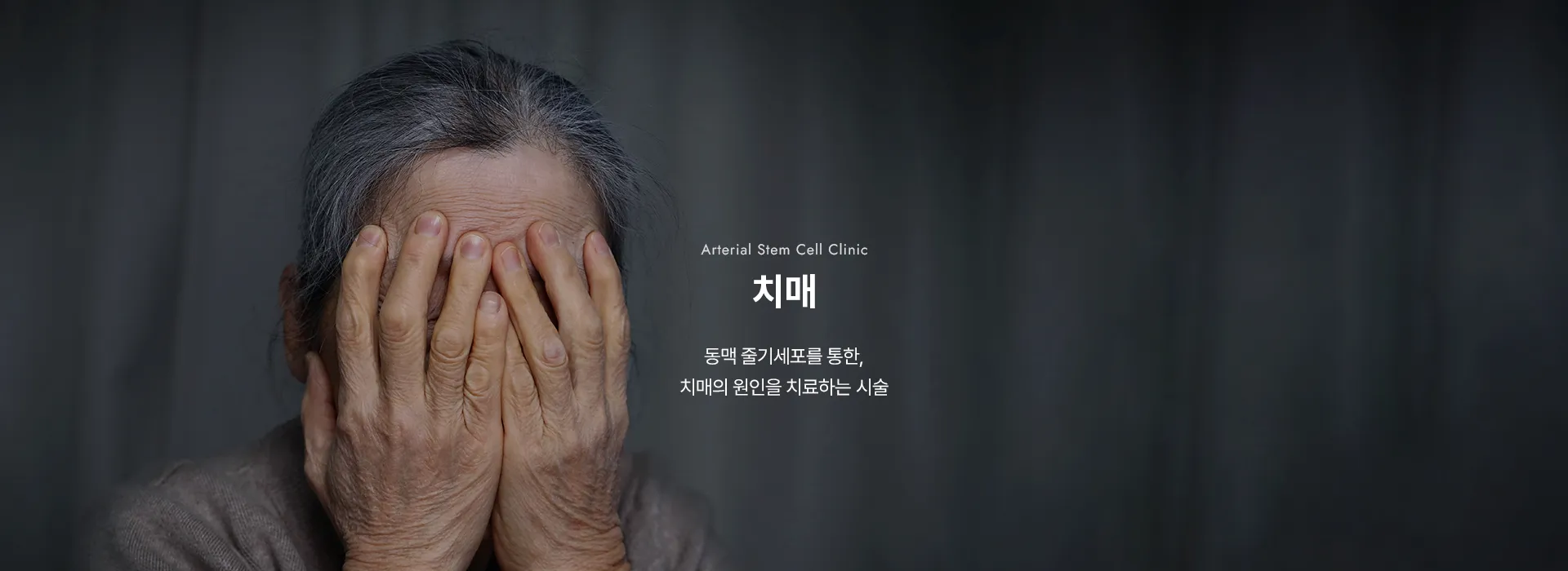 Arterial Stem Cell Clinic · 치매 · 동맥 줄기세포를 통한, 치매의 원인을 치료하는 시술