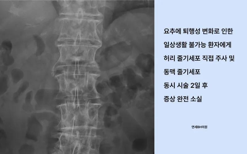 연세BH의원의 퇴행성 관절염 치료